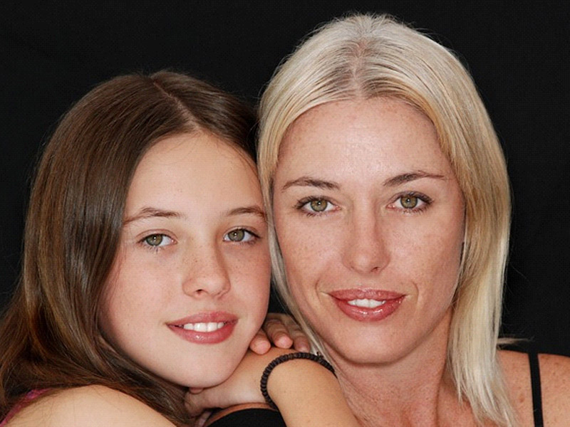 Kompozitna nadogradnja - Studio Dent 011