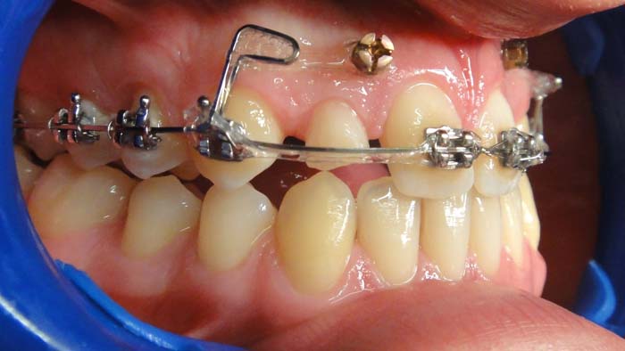 Tads - Studio Dent 011