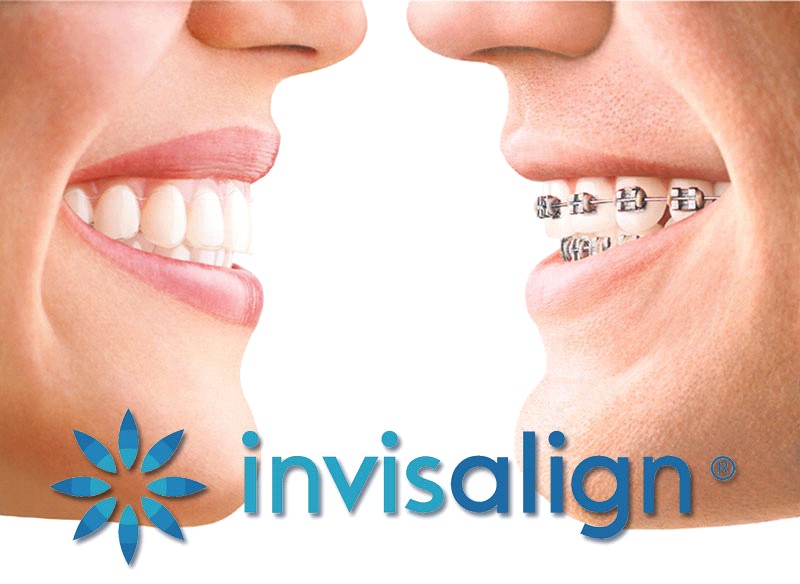 Terapiaja za odrasle - Studio Dent 011