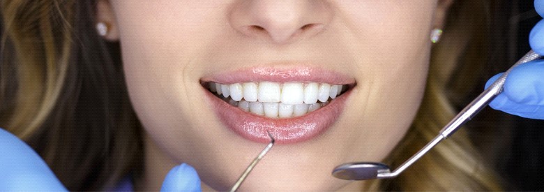 Terapija odraslih - Studio Dent 011